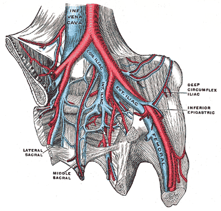 What is May-Thurner syndrome?

- left common iliac vein compression by right common iliac artery
- causes DVT
- More common in women
- Patients often require thrombolysis, anticoagulation, and or vascular intervention