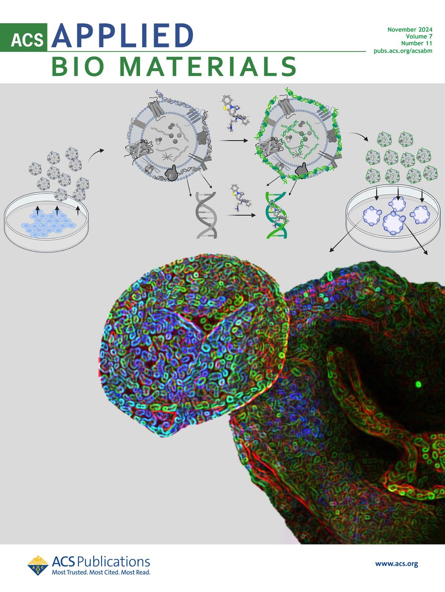 Sagar Rayamajhi (@rayamajhi_sr) on Twitter photo PicoGreen labeled EVs (PG-EVs) offer minimally invasive labeling of EVs and allow for tracking in 3-dimensional organoid models—current ACS cover art showing PG-EV internalization in human fallopian tube-derived organoids. <a href="/ACS4Authors/">ACS for Authors</a> #MyACSCover
pubs.acs.org/toc/aabmcb/7/11 PicoGreen labeled EVs (PG-EVs) offer minimally invasive labeling of EVs and allow for tracking in 3-dimensional organoid models—current ACS cover art showing PG-EV internalization in human fallopian tube-derived organoids. <a href="/ACS4Authors/">ACS for Authors</a> #MyACSCover
pubs.acs.org/toc/aabmcb/7/11