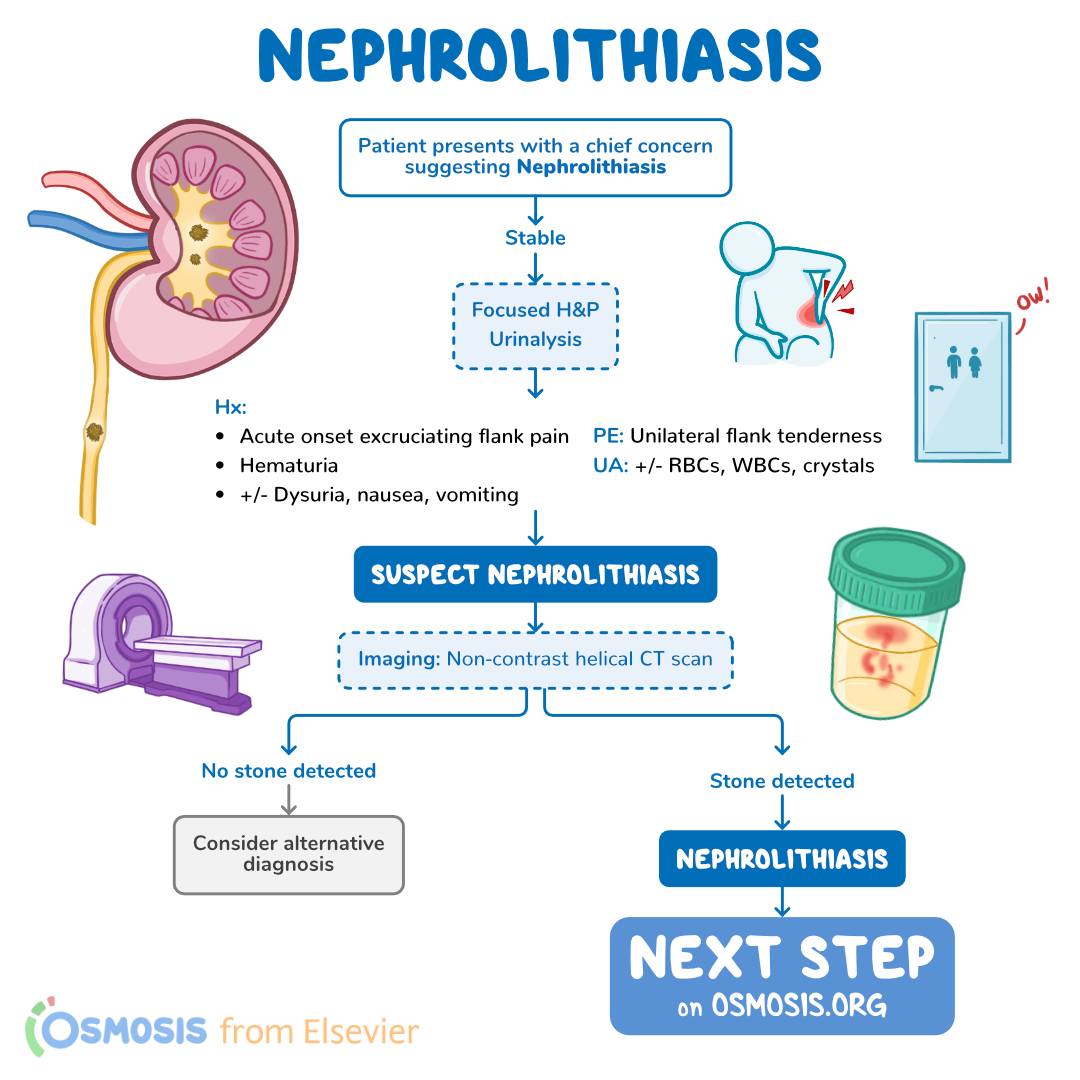 OsmosisMed's tweet photo. Today's #DecisionTreeBranch is about #nephrolithiasis (renal calculi/stones). It's a painful condition where crystals form in the kidney, potentially causing #UrinaryTractObstruction.
Learn more: https://t.co/f6C7TLjke7
Try Osmosis from Elsevier for free: https://t.co/cN1WjLytDV https://t.co/Gg6fHW00oy