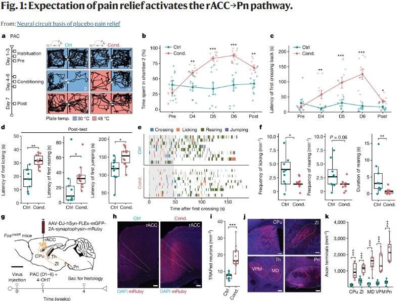 UnidadFaseIMad's tweet photo. What Is the Neural Basis of Placebo Pain Relief? Scientists Discover Brain Circuits for Placebo Effect Pain Relief: It may revolutionise pain relief.

#UnderstandingPlacebo #PANACEAresearch #PlaceboAdvantages #PlaceboEffect #PainManagement #HealthResearch #ScienceOfPain https://t.co/GodXP502n5