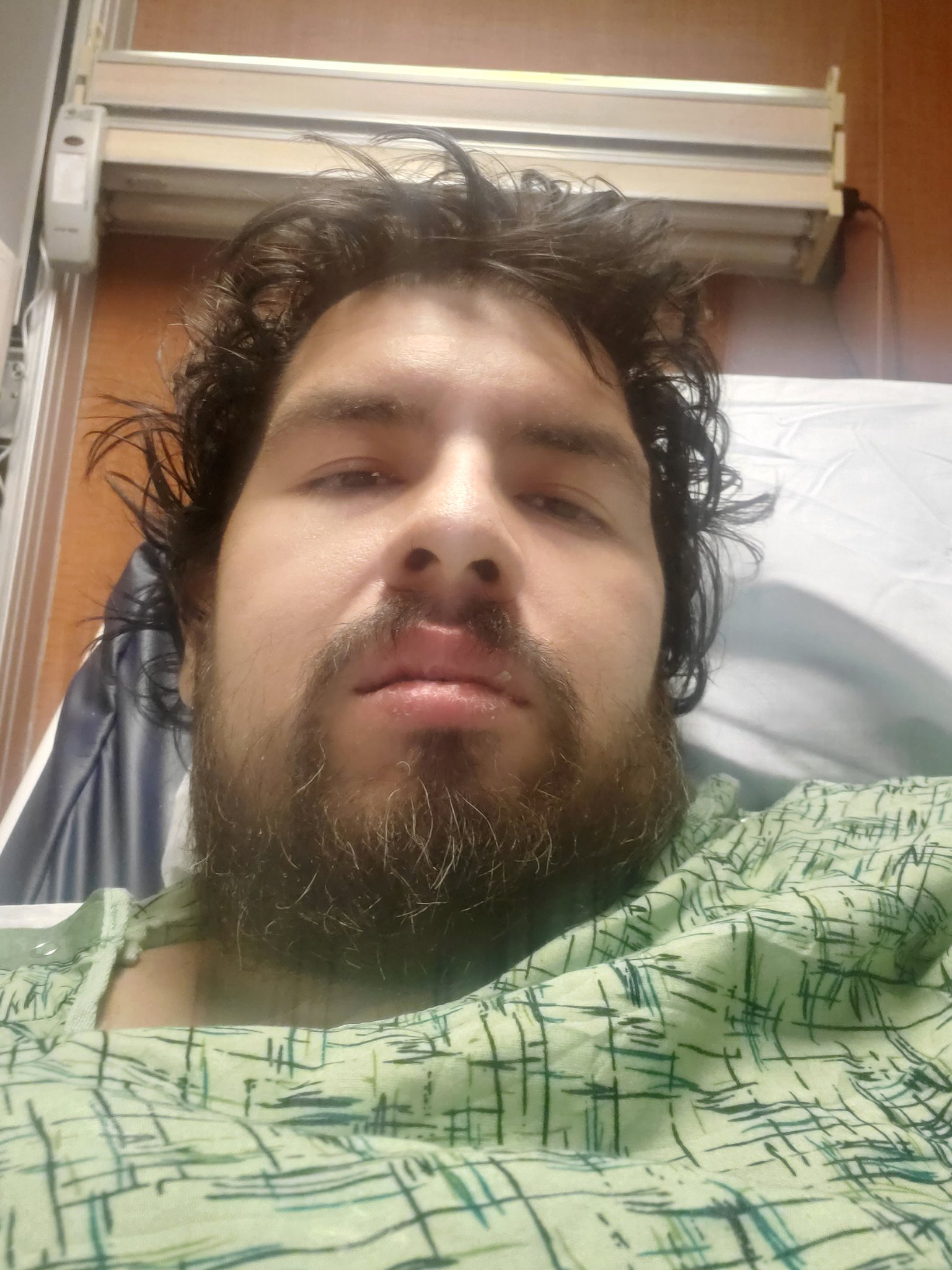Been in the hospital for 2 and a half months for Necrotizing fasciitis of the chest. https://t.co/PSqDSrmXfl
