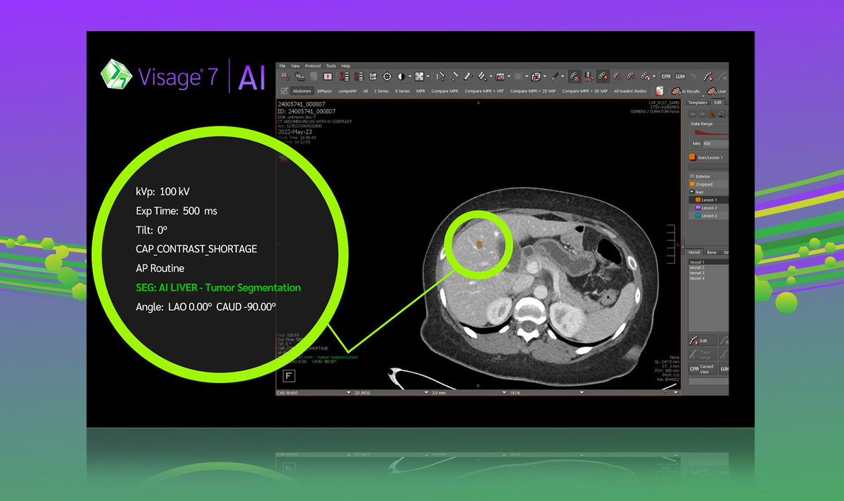 Check out the latest Visage Blog: AI Results | Visage Leading the Way in Transparency 

hubs.la/Q02Yxc5D0

#Visage7AI #AI #AIResults #AIR #IHE #SaMD #CloudPACS #Visage7 #SaaS #PlatformForTheFuture #PoweredBySpeed