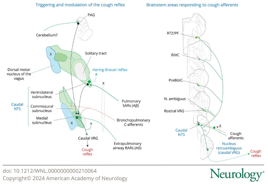 Neurology Journal (@greenjournal) on Twitter photo What Are the Central Mechanisms of Cough and Their Neurologic Implications? bit.ly/3CmxKn1
#NeuroX #NeuroTwitter What Are the Central Mechanisms of Cough and Their Neurologic Implications? bit.ly/3CmxKn1
#NeuroX #NeuroTwitter
