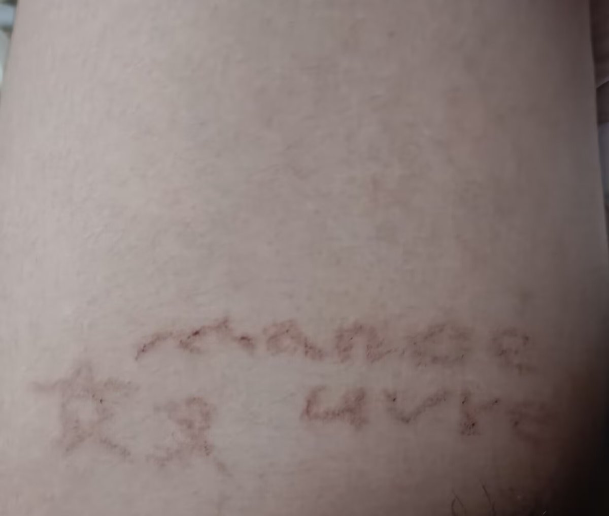 刺上主人的印记才是身心臣服的开始，恢复一段时间后 ＃圈养 ＃母狗 #拳交 #扩张 #贱b #强制 #强高 #笼子 #肉便器 #调教 #囚禁 #SM #字母圈 ＃贱狗 #母畜 #女M #性瘾 #女大 #自毁 #反差 #男尊女卑 #调教 #骚货 #找主 #胁迫 #雌竞 #反差婊 #母猪 #炮机 #sp #m #恋痛 #堕落 #虐待 #洗脑 #上贡 #女德 #认主