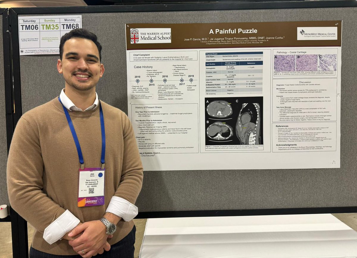 Our second year fellow, Dr. Jose Garcia, presenting on Fungal Septic Costochondritis at <a href="/ACRheum/">American College of Rheumatology</a> #ACR2024 #acr24 #Rheumatology #rheumtwitter