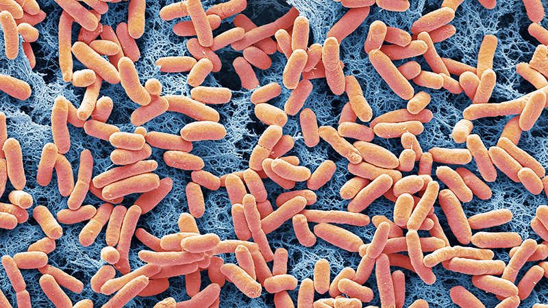 EmpiricGame's tweet photo. Go ahead and tell me this is a coincidence.
#ecolioutbreak #carrots https://t.co/a9sLbYeWyV