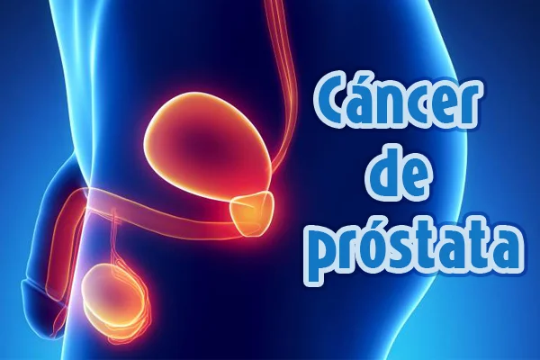 jesus_osorior's tweet photo. Conciencia del cáncer de próstata:

El cáncer de próstata es uno de los cánceres más comunes en los hombres, pero detectarlo temprano es un cambio de juego.

Este hilo explica todo lo que necesita saber sobre esta condición en términos simples, trato de responder algunas preguntas famosas que pueda tener...

[Todo hombre debería ver esto]

-Hilo-