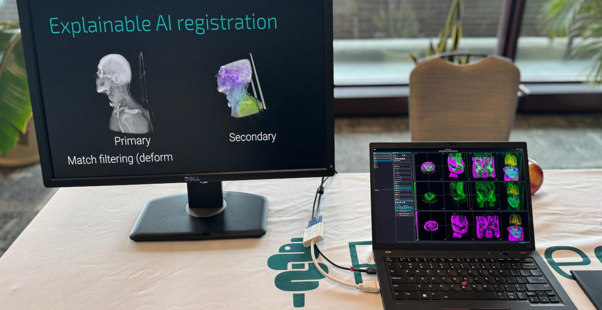 pymedix's tweet photo. #Pymedix had a great time connecting with other companies and institutions during #AAPM Midwest Chapter Meeting last Saturday.

Level up your planning workflow with the most robust AI in #Autofuse. 

info@pymedix.com https://t.co/hiLYJXc8yY