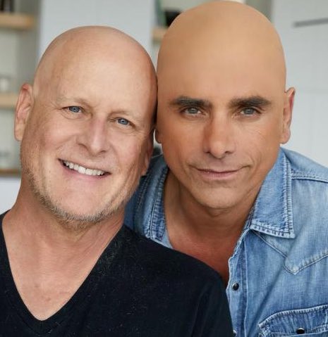 John Stamos is facing backlash for wearing a bald cap in “solidarity” with his ‘Full House’ co-star Dave Coulier, who was diagnosed with cancer.