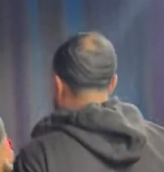 11queenQ's tweet photo. @AsianDaBrattt The bald spot is wild #myron #FreshAndFit #bald  #freshandfitpodcast https://t.co/FADyt3hzrl