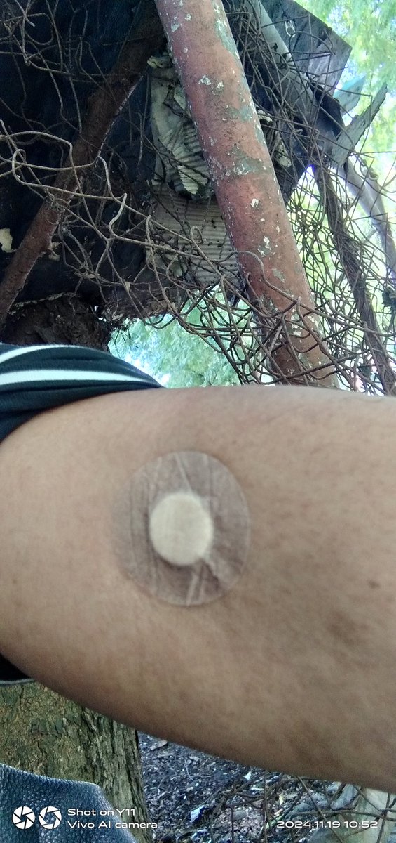 dark_eithan's tweet photo. Anniversary feels
VL and CD4 test with other lab test
Left and right talaga https://t.co/fSWt0dI9hF