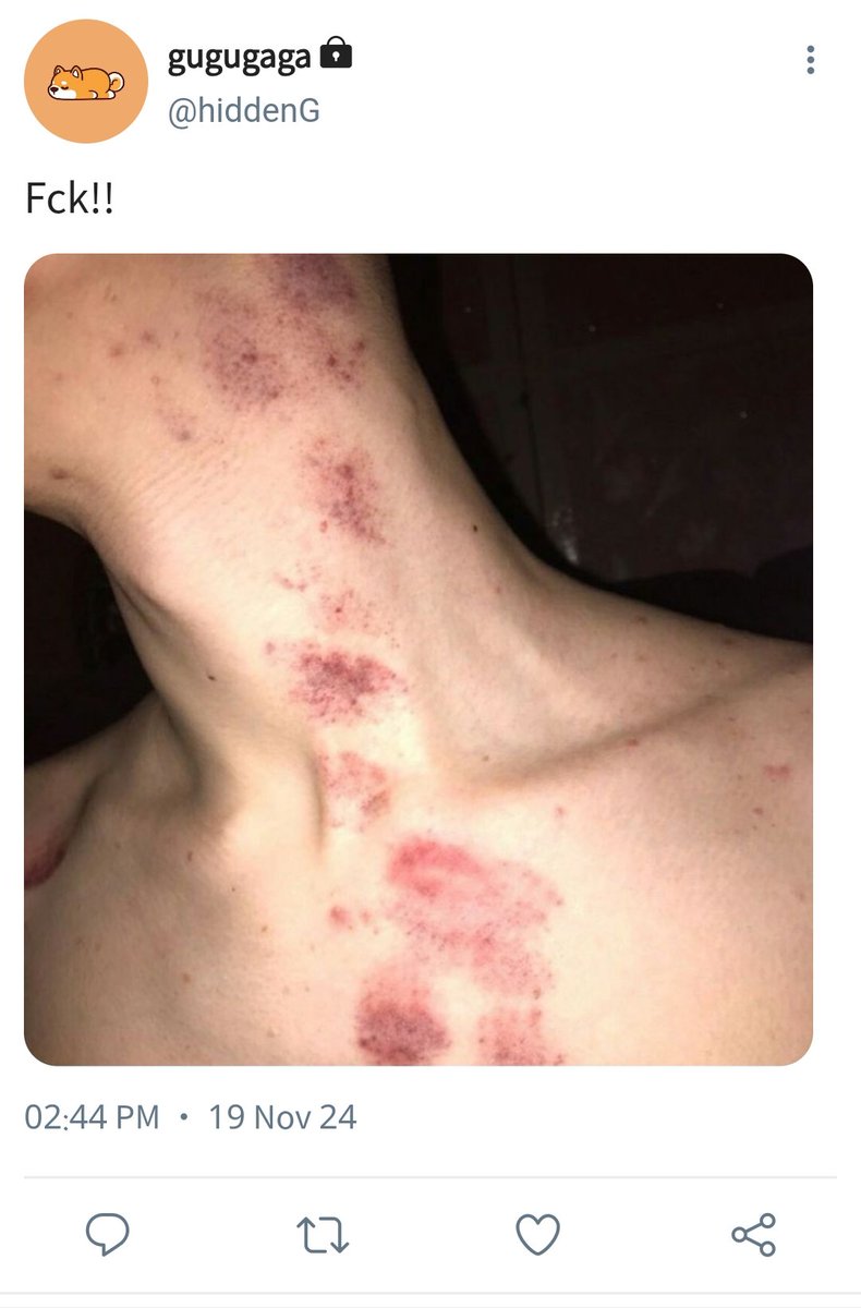 Rmey93's tweet photo. #JossGawin few tweet au
- ABOverse (Alpha x Alpha) 🔞

From this                        To this https://t.co/GniPwOXqwH