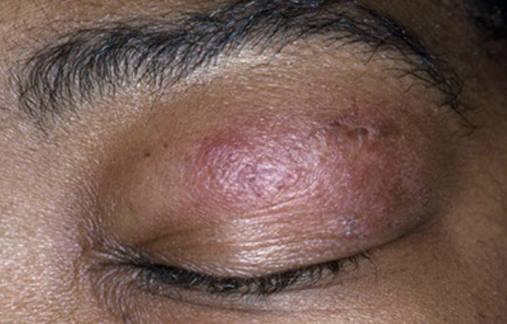 Marianne Signoret tweet media