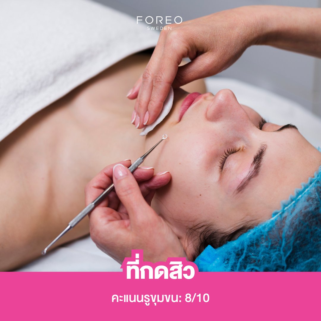 ForeoThailand's tweet photo. การดูแลรูขุมขน: 5 วิธีทำความสะอาด

รู้หรือไม่!? ว่าผู้ใหญ่มีรูขุมข��ประมาณ 5 ล้านรูทั่วร่างกาย (ยกเว้นฝ่ามือและฝ่าเท้า) ซึ่งก่อนอื่นนั้น เรามาทำความรู้จัก 'รูขุมขน' ก่อนดีกว่า...

รูขุมขน คือ ช่องเปิดขนาดเล็กที่น้ำมันหรือซีบั่มที่ร่างกายผลิตส่งผ่านไปยังผิวหนัง ดังนั้นจึงเป็นเรื่องปกติอย่างยิ่งที่รูขุมขนจะเกิดการอุดตัน ด้วยเหตุผลหลายประการ เช่น น้ำมันส่วนเกินที่เกิดจากการเปลี่ยนแปลงของฮอร์โมน ผิวแห้ง การสะสมของเซลล์ผิวที่ตายแล้ว หรือสิ่งสกปรกและน้ำมันที่ติดอยู่ใต้พื้นผิว แม้ว่ารูขุมขนอุดตันจะ��บได้บ่อยที่สุดบนใบหน้า แต่จริง ๆ แล้วก็สามารถปรากฏได้ทั่วร่างกายเช่นกัน

และเมื่อผิวหนังปิดทับรูขุมขนที่อุดตัน คุณก็จะได้พบกับ 'สิว' วันนี้ FOREO จึงขอแชร์ 5 วิธีในการทำความสะอาดรูขุมขน เพื่อให้คุณสามารถลดรูขุมขนได้อย่างง่ายดายและได้ผลลัพธ์สูงสุด

1. แผ่นลอกสิว

เวลาที่เราเพิ่งลอกแผ่นลอกสิวออกใหม่ ๆ โดยส่วนใหญ่เรามักที่จะตรวจสอบบนแผ่นลอกสิวและพบกับสิ่งสกปรกทั้งหมดที่เพิ่งดึงออกจากใบหน้าของเรา แต่จริง ๆ แล้ว ประสิทธิภาพของแผ่นลอกสิวนั้นมีผลตอบแทนน้อยกว่ามากกว่าที่คุณคิด เนื่องจากแผ่นลอกสิวมีส่วนผสมที่ถูกกระตุ้นด้วยน้ำ ซึ่งยึดติดกับชั้นบนสุดของสิ่งสกปรก น้ำมัน และเซลล์ผิวที่ตายแล้ว ดังนั้น สิ่งที่คุณเห็นส่วนใหญ่มาจากผิวหนังชั้นนอกเท่านั้น ซึ่งถือว่า 'แผ่นลอกสิว' ไม่ใช่ทางเลือกที่ดีที่สุดระยะยาวสำหรับการ���ำจัดรูขุมขนที่อุดตัน

คะแนนรูขุมขน: 4/10

2. สครับ

ควรเลือกสครับที่มีส่วนผสมที่ช่วยต่อต้านการเกิดสิวได้ เช่น กรดซาลิไซล��ก ตัวช่วยกำจัดเซลล์ผิวชั้นบนสุดที่ตายไปแล้ว สิ่งสกปรก และน้ำมัน รวมถึงยังช่วยดึงสิ่งสกปรกออกจากรูขุมขนที่อุดตัน แต่ไม่ควรใช้มากเกินไป เพราะการสครับแรงเกินไปหรือบ่อยเกินไป อาจทำให้ผิวของคุณเสียหายได้ ควรสครับเพียง 1 ครั้ง/สัปดาห์ เท่านั้น

คะแนนรูขุมขน: 6/10

3. ที่กดสิว

ด้วยตัววงกลมเล็ก ๆ จะเป็นตัวกำหนดเป้าหมายของสิวและกำจัดสิวหัวดำได้อย่างแม่นยำโดยที่ไม่ต้องใช้มือ ซึ่งถือว่าวิธีนี้มีประสิทธิภาพอย่างไม่ต้องสงสัย แต่หากคุณศึกษาวิธีการทำไม่ดีพอหรือทำผิดวิธี ก็อาจจะทำให้เกิดอันตรายได้ ซึ่งอาจทำให้เกิดแผลเป็นหรือดันสิ่งสกปรกให้เข้าไปในรูขุมขนลึกมากขึ้นนั่นเอง

คะแนนรูขุมขน: 8/10

4. แปรงทำความสะอาดใบหน้า

เพื่อป้องกันไม่ให้รูขุมขนของคุณเกิดการอุดตัน การที่เราเพิ่มวิธีทำความสะอาดใบหน้าด้วยแปรงทำความสะอาดใบ��น้าแบบโซนิคเข้าไปในกิจวัตรประจำวัน ก็ถือเป็นวิธีที่ยอดเยี่ยมทีเดียว ซึ่งก็คือ เครื่องล้างหน้าอัจฉริยะ LUNA™ 4 ด้วยตัวขนแปรงซิลิโคนที่นุ่มกว่าเดิมถึง 17% และนวัตกรรมการสั่นสะเทือน T-Sonic™ เพื่อผลัดเซลล์ผิวที่ตายแล้วและขจัดสิ่งสกปรกที่สามารถ��ุดตันรูขุมขนของคุณออก มีการพิสูจน์ทางคลินิกแล้วว่าสามารถขจัดสิ่งสกปรก น้ำมัน และคราบเครื่องสำอางได้ 99% อีกทั้ง LUNA™ 4 ยังช่วยส่งเสริมการไหลเวียนเลือดได้ดีอีกด้วย สามารถใช้ได้ 2 ครั้ง/วัน

คะแนนรูขุมขน: 9/10

5. ผู้เชี่ยวชาญด้านผิวหน้า

การนัดหมายกับผู้เชี่ยวชาญควรเป็นขั้นตอนที่จำเป็นในกิจวัตรของคุณ เพื่อกำจัดสิ่งสกปรกออกจากรูขุมขนที่อุดตัน เนื่องจากพวกเขารู้วิ���ีกำจัดสิวหัวดำโดยไม่ทำลายผิวหนังของคุณ ในขณะที่คุณเพียงแค่นอนและผ่อนคลายไปกับเสียงเพลงที่สปา

คะแนนรูขุมขน: 10/10