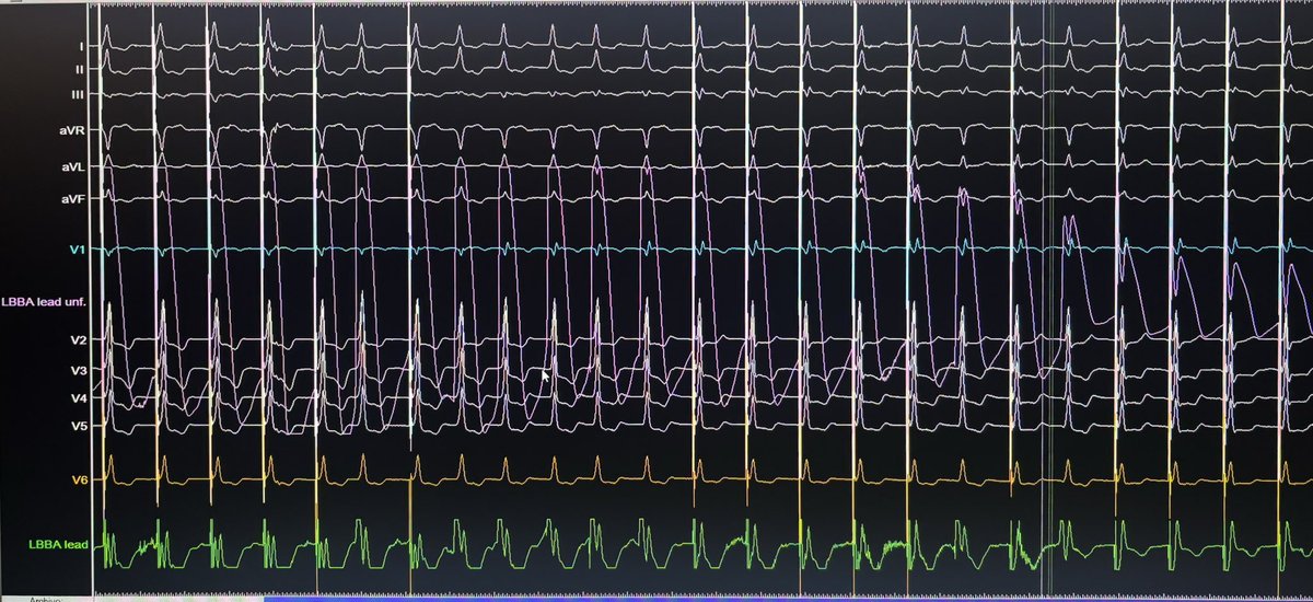 Kevin Vernooy tweet media