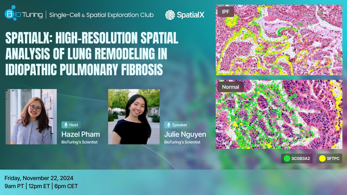 🫁Join Friday's Webinar and explore the spatial analysis of lung remodeling in Idiopathic Pulmonary Fibrosis with SpatialX bioturing.com/spatialx

Webinar Details:
📅 Date: Friday November 22nd
⏰ Time: 9am PT | 12pm ET | 6pm CET
🔗 Register us02web.zoom.us/webinar/regist…

#spatialx