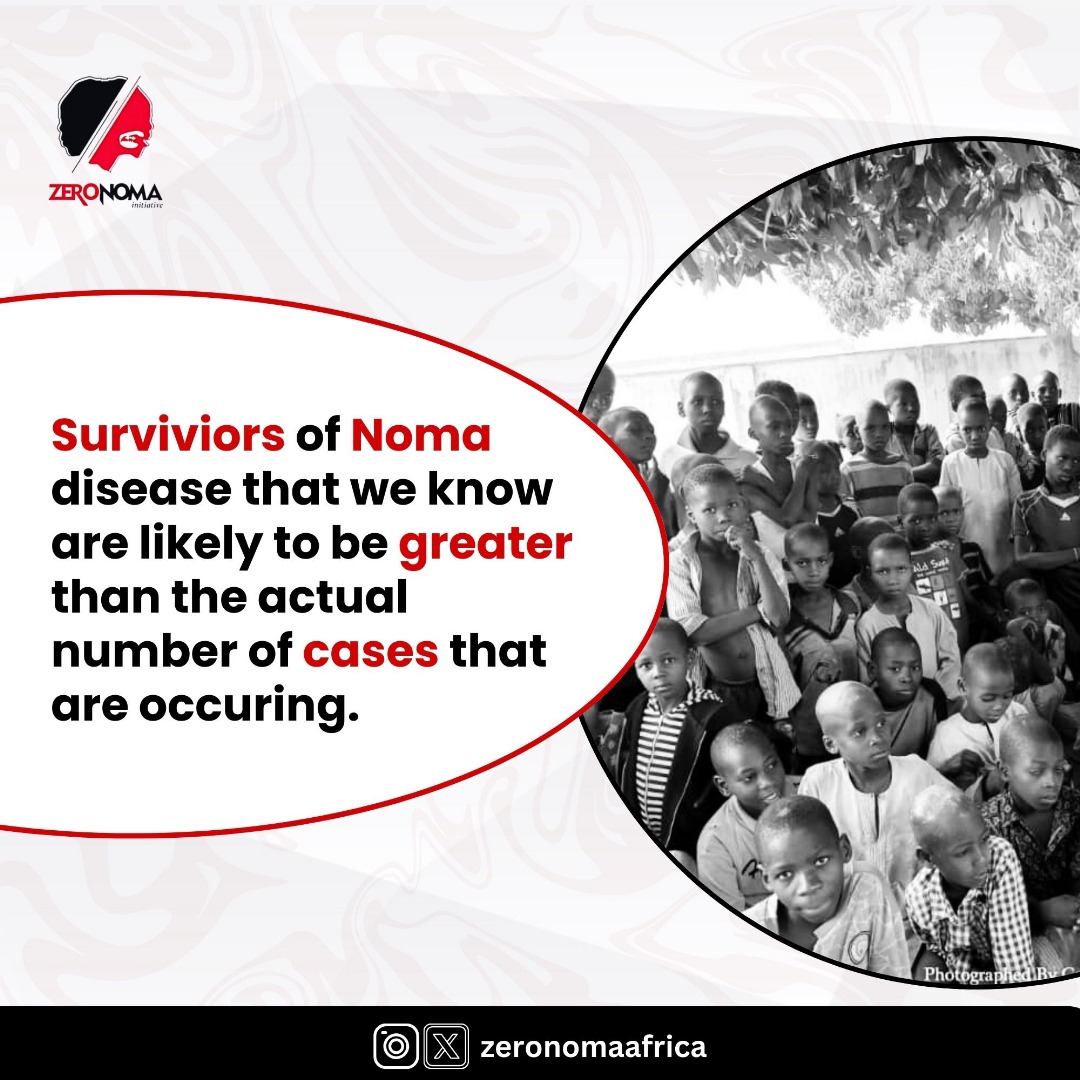 ZeronomaAfrica's tweet photo. The high mortality and long distance to care are possible reasons for cases that are unreported 

Day 24
#50DNA #Zeronoma 
#HighMortality #BeatNTDs 

@WHO  @WHOAFRO @WHONigeria https://t.co/lbFoiM5iky