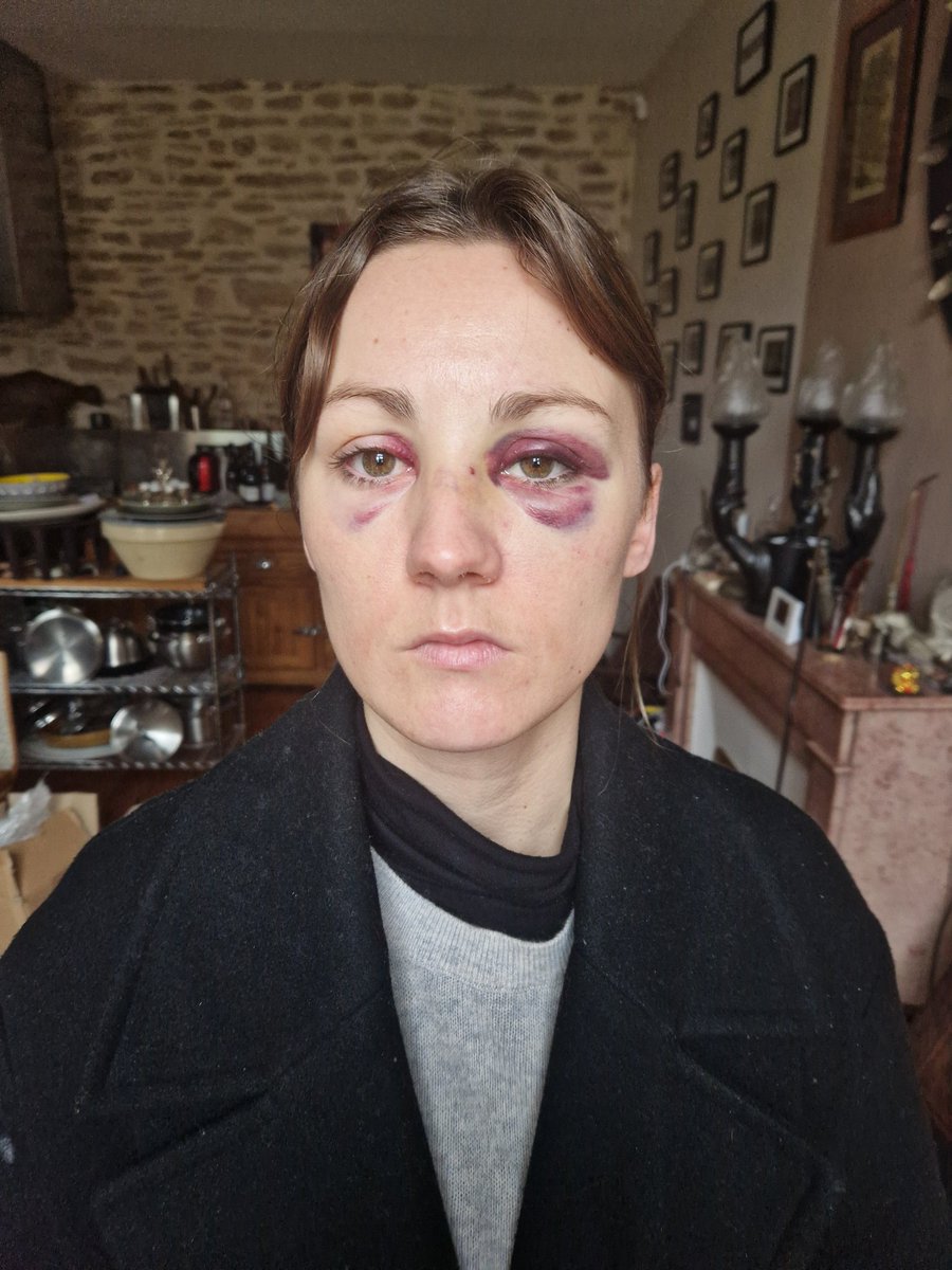 Voici le visage de ma fille agressée à Beaune, dans la rue, dans la nuit de samedi à dimanche <a href="/Coll_Nemesis/">Collectif Némésis</a> par Alexandre Landre commissaire priseur.