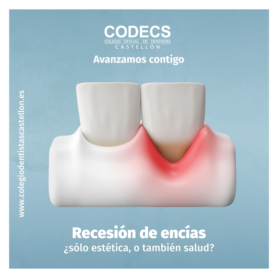 codecs_'s tweet image. La recesión de encías, a pesar de su visibilidad e impacto sobre la sonrisa, no es una cuestión simplemente estética. Sino se interviene, se puede acabar con la pérdida total del diente.
👉🏻 cutt.ly/oeKyOEG5