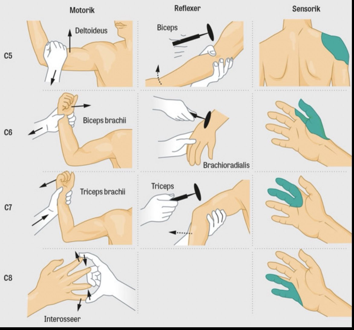 OGdukeneurosurg's tweet photo. Arm exam https://t.co/kFKjXhBuy9