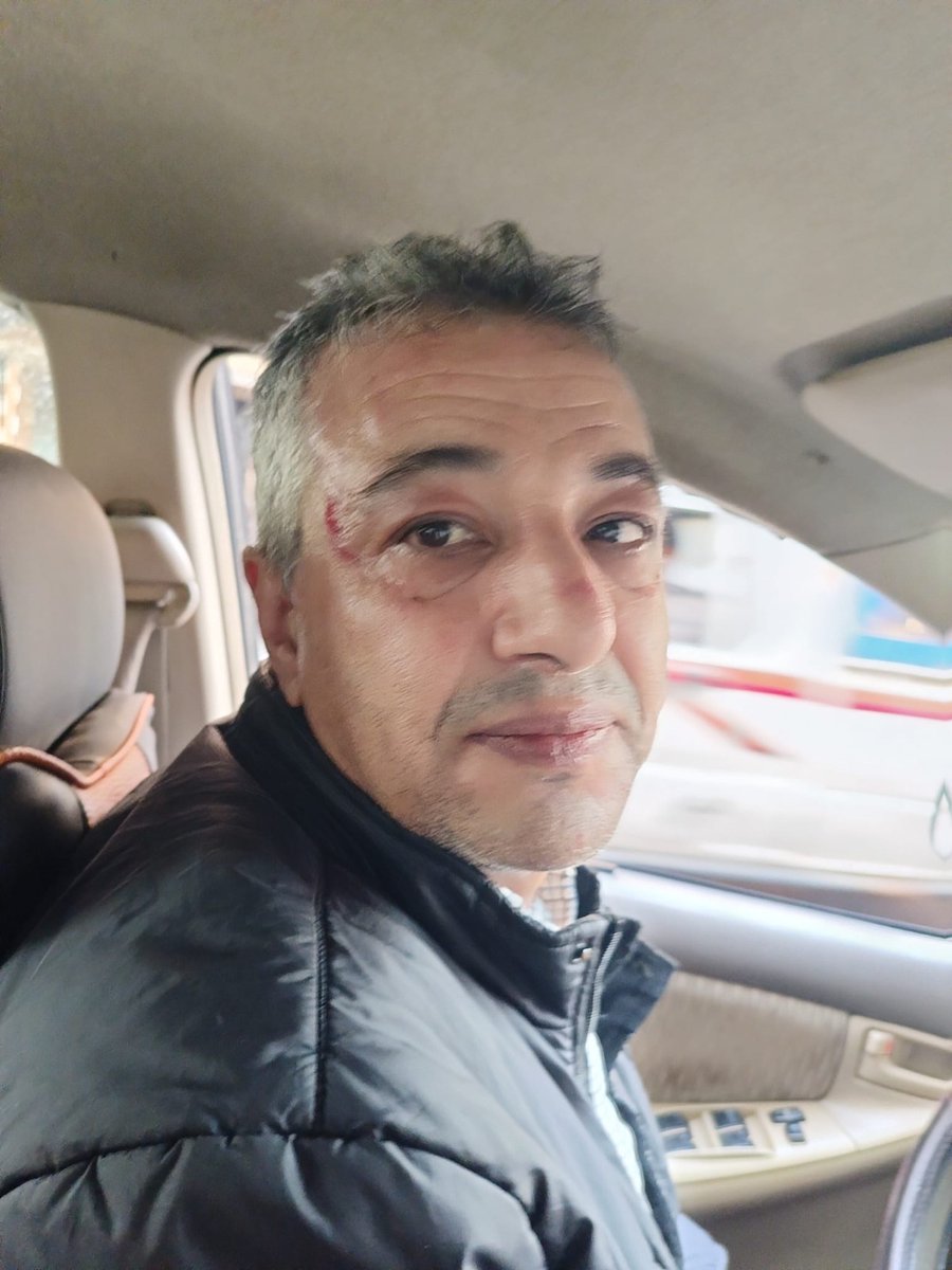 Equipe_Media's tweet photo. Mohamed Mayara, periodista saharaui de Equipe Media, fue víctima de una agresión brutal por parte de marroquíes vestidos de civil en una motocicleta. Condenamos este acto y pedimos protección para los periodistas en los territorios ocupados. https://t.co/ECpIzTxWZl