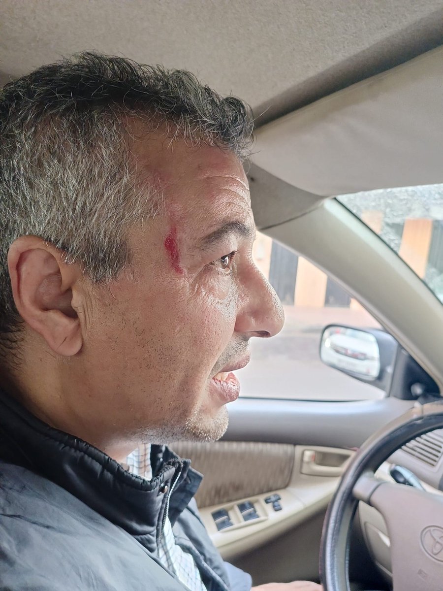 Equipe_Media's tweet photo. Mohamed Mayara, periodista saharaui de Equipe Media, fue víctima de una agresión brutal por parte de marroquíes vestidos de civil en una motocicleta. Condenamos este acto y pedimos protección para los periodistas en los territorios ocupados. https://t.co/ECpIzTxWZl