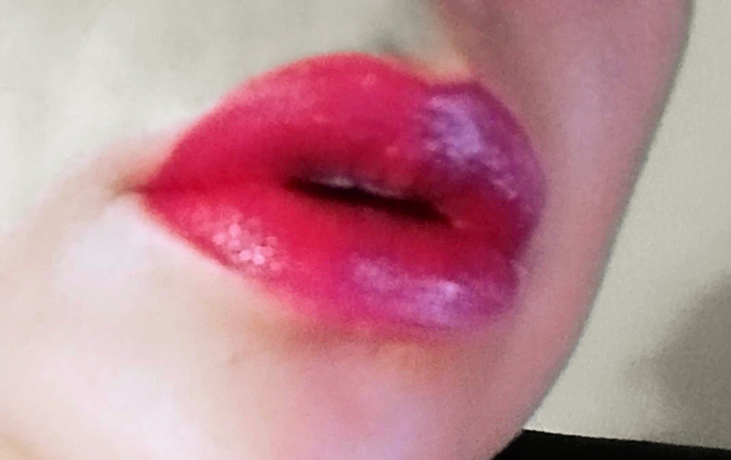 Besitos😋
