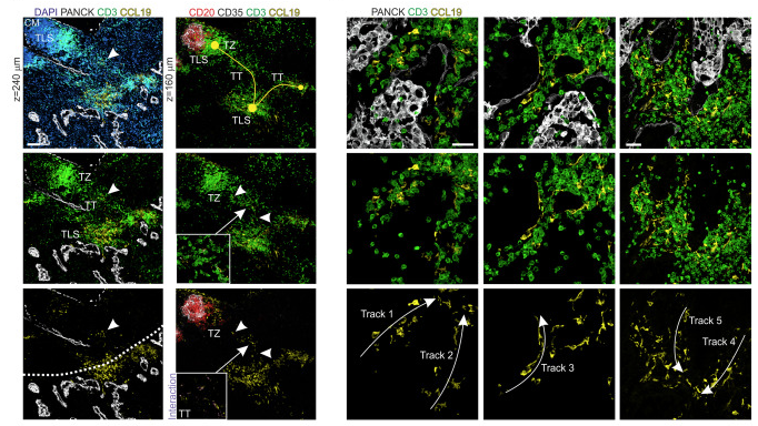 Specialized fibroblastic reticular cells underpin interconnected T cell environments with dedicated microenvironmental niches that promotes antitumor immunity in lung cancer <a href="/CellCellPress/">Cell</a> @ImmunobiologySG
cell.com/cell/fulltext/…