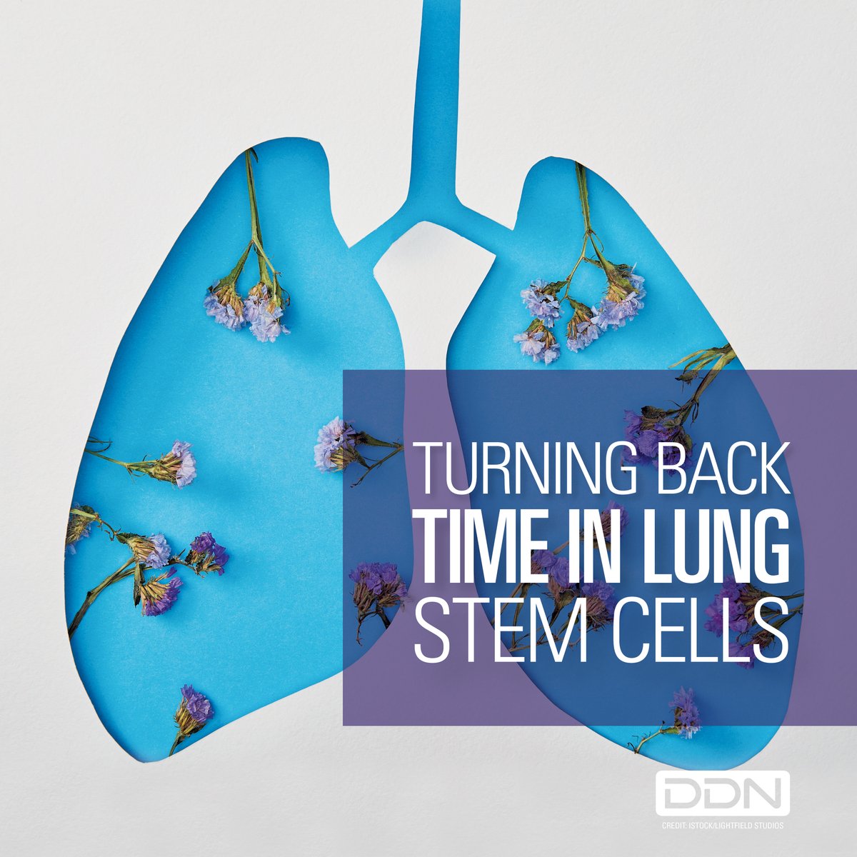 Drug Discovery News (@drugdiscovnews) on Twitter photo In a high-throughput screen of repurposed drugs, <a href="/MichaelBollong/">Michael Bollong</a> <a href="/scrippsresearch/">Scripps Research</a> and his team identified a drug that turns back time on aged lung stem cells.
It may be a new treatment for idiopathic pulmonary fibrosis, he told <a href="/sci_steph/">Stephanie DeMarco, PhD</a>.
Read more: ow.ly/K8zV50U9wsV In a high-throughput screen of repurposed drugs, <a href="/MichaelBollong/">Michael Bollong</a> <a href="/scrippsresearch/">Scripps Research</a> and his team identified a drug that turns back time on aged lung stem cells.
It may be a new treatment for idiopathic pulmonary fibrosis, he told <a href="/sci_steph/">Stephanie DeMarco, PhD</a>.
Read more: ow.ly/K8zV50U9wsV