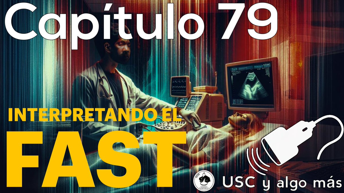 ¿Sabes cómo interpretar el FAST en  trauma? Acá te explicamos paso a paso
👉 Colocación del transductor
👉 Artefactos de líquido libre
👉 Toma de decisiones según el estado hemodinámico 💡
¡No te lo pierdas! 

youtu.be/xLyzk4zwcLU

#Ultrasonido #FAST #Trauma #Medicina