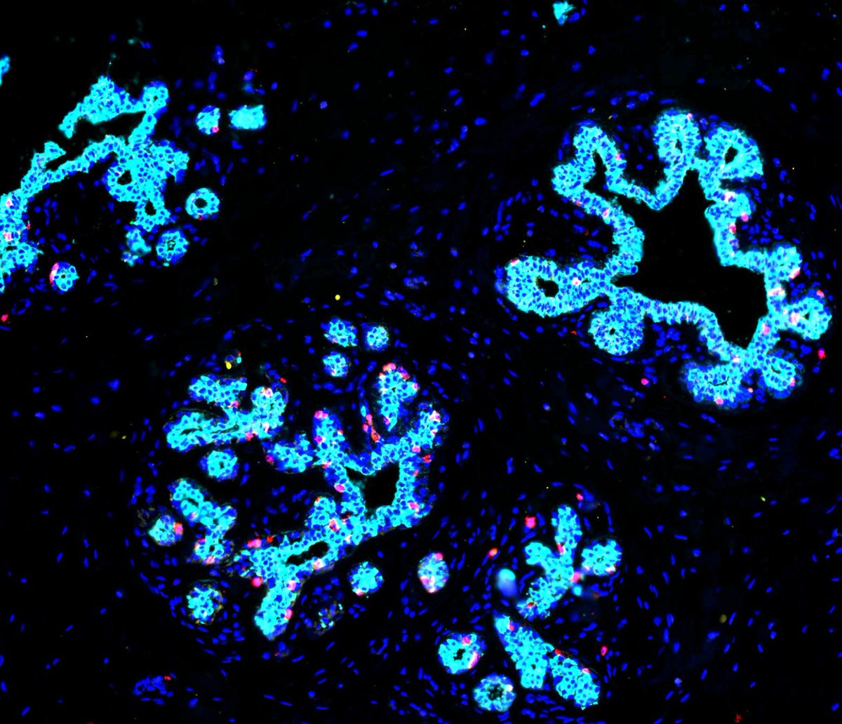 Visikol's tweet photo. One critical step in the IHC process is antigen retrieval, which involves treating tissue samples to expose antigens that may be masked by fixation. Read more here --> https://t.co/zwUIKIDyYl

#Visikol #IHC #AntigenRetrieval https://t.co/mAUzzU3XAp