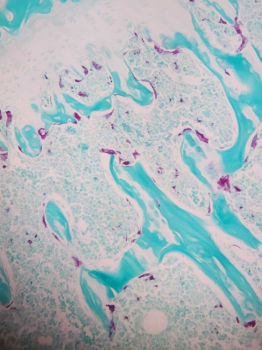 What are we staining today? Some pretty osteoclasts (and a few osteocytes) with TRAP on FFPE sections 
#histology #bone