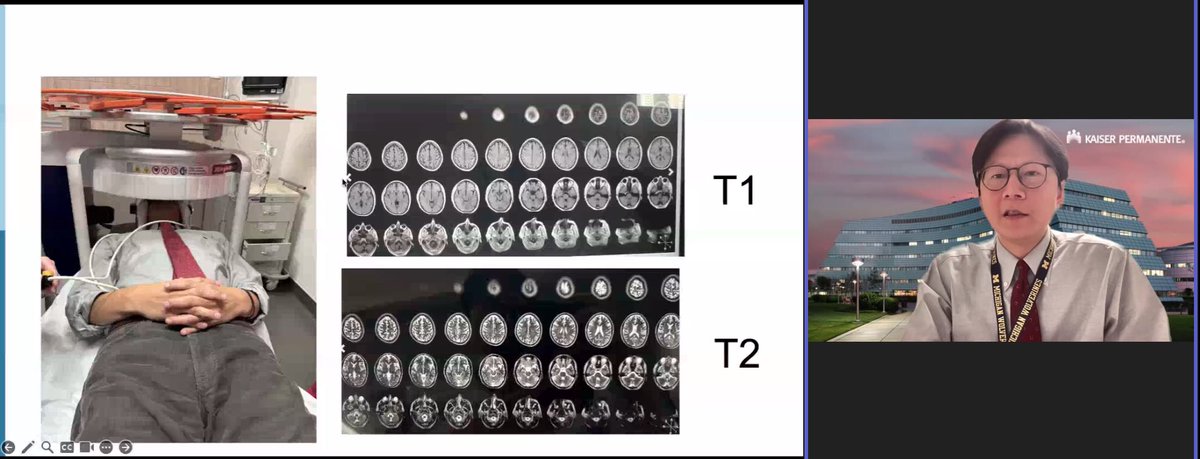 songMD's tweet photo. “A complex disease, HIE is.” - Dr. T. Wu, #NeoYoda

Neurons- most sens &amp; 1st to feel injury

Timing of injury can guide Rx- is early, pre-TH MRI be our future?

Note dedication this dedicated researcher using himself as Subject Zero in portable MRI…

#NeoBrain
#NeoGrandRounds https://t.co/qV65rCv92B