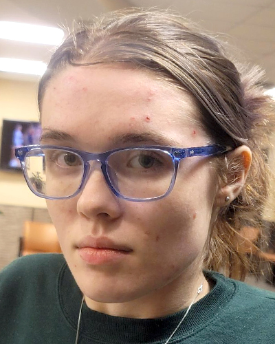 NCMEC's tweet image. It’s been nearly nine months since 17-year-old Savanna Pappendick went #missing, and we need your help to find her.

Savanna was last seen on February 26, 2024, in Mansfield, Ohio. She may have traveled to Towson or St. Mary’s County, Maryland. 

If you have any information, call…