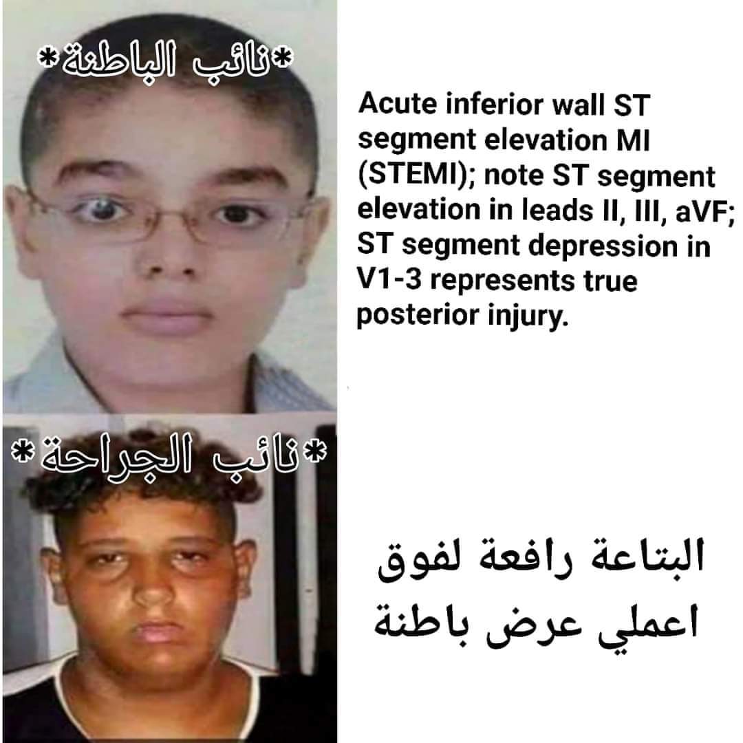 Moaz Abouelmagd (@moazelsayed2023) on Twitter photo 