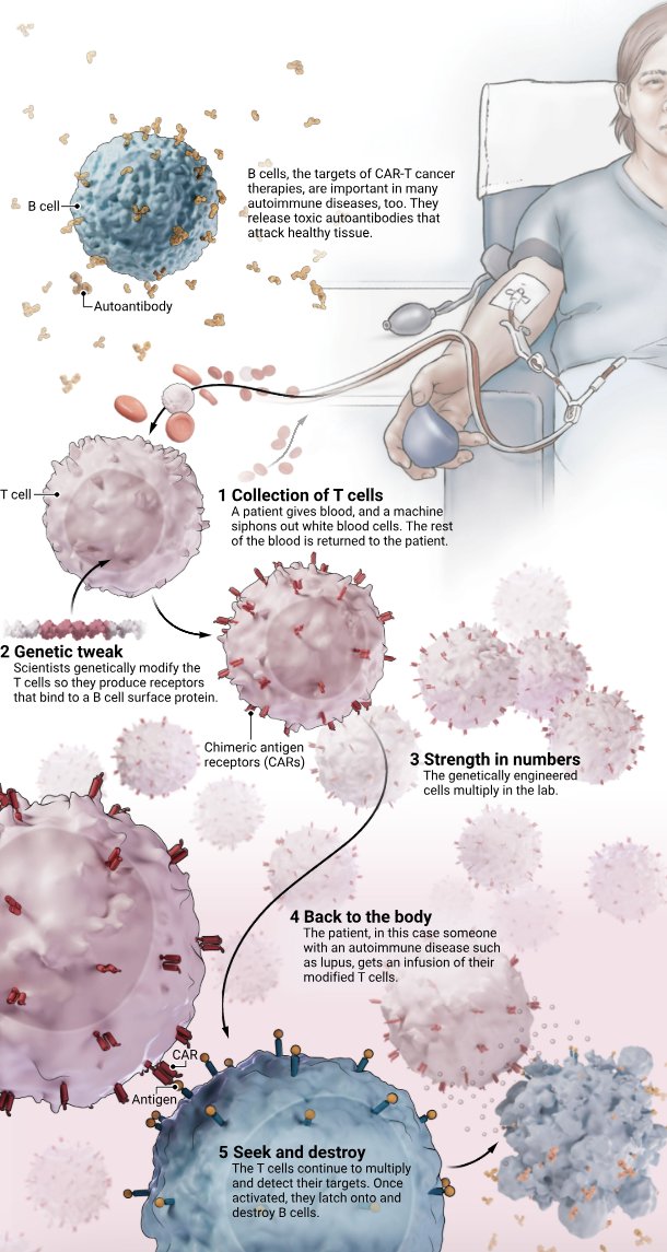 Science Magazine (@sciencemagazine) on Twitter photo Chimeric antigen receptor T-cell (CAR-T) therapy, already approved for certain blood cancers, is generating excitement in early tests against autoimmune diseases. Designed to wipe out a whole class of immune cells, the treatment holds promise but comes with potentially serious Chimeric antigen receptor T-cell (CAR-T) therapy, already approved for certain blood cancers, is generating excitement in early tests against autoimmune diseases. Designed to wipe out a whole class of immune cells, the treatment holds promise but comes with potentially serious
