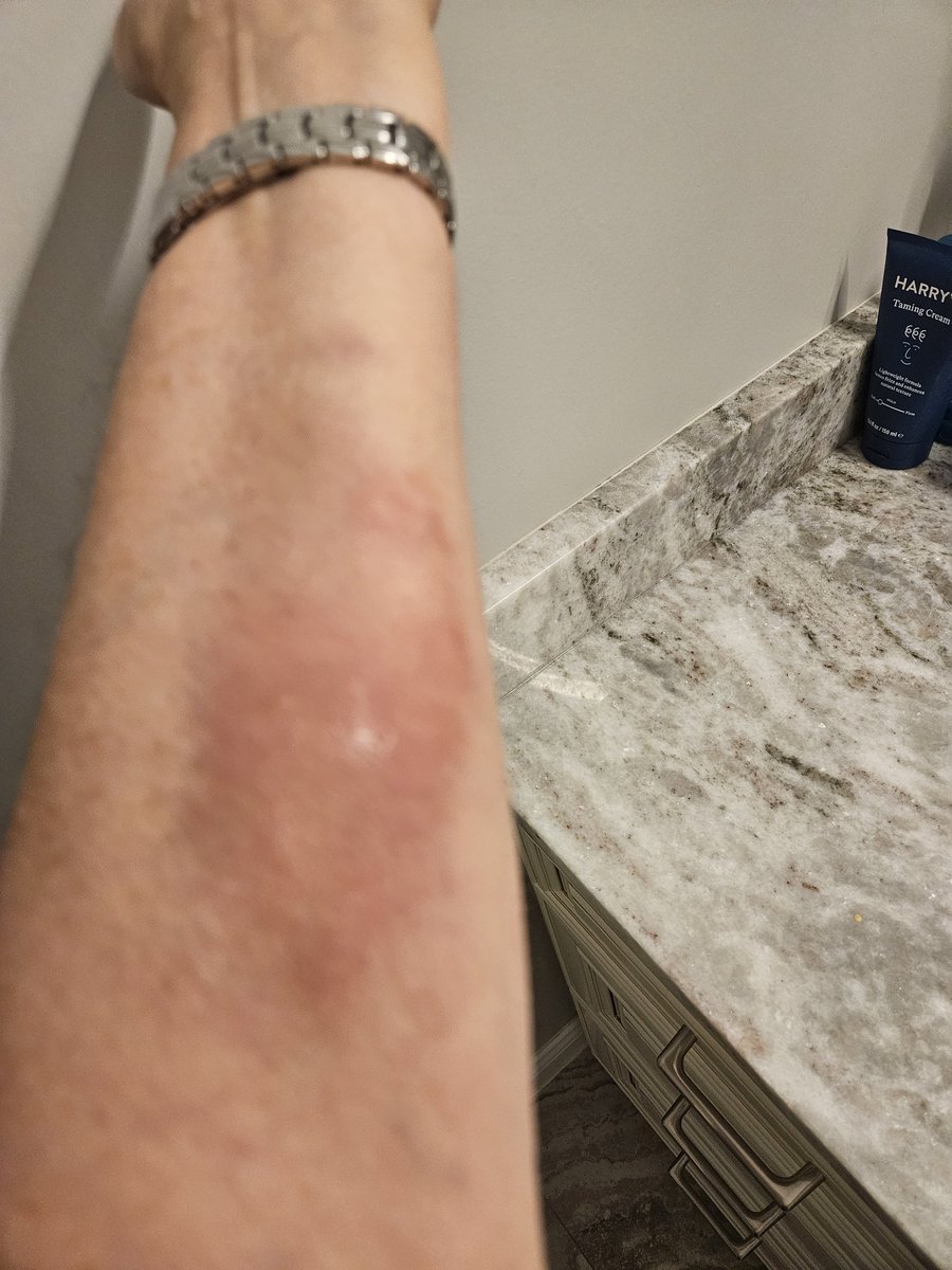 ABwithus's tweet image. Congratulations. God bless. I can't wait for that day. It seems so close but so far away. 6 weeks ago, I was diagnosed with stage 3 ovarian cancer. Finished my second chemo a week ago.