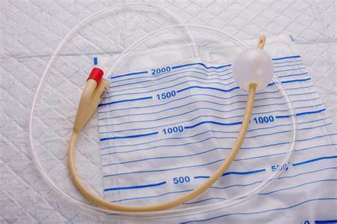 akhadam77's tweet photo. Seri Edukasi Urologi (Untuk Dokter Muda)
Apa yang anda lakukan kalau terjadi retensi urine  di IGD?

Bismillaah
Saya akan berikan ilustrasi kasus, seorang laki2 umur diatas 50 tahun mengeluh tidak bisa kencing dan datang ke IGD tempat saudara bertugas.  Pada anamnesis didapatkan ini kasus retensi yang pertama kali dan memang sebelumnya ada riwayat LUTS/Lower Urinary Tract Symptoms (kencing tidak lancar, pancaran kencing melemah, nokturia > 2 kali, menetes di akhir kencing). Perut bawah terasa penuh dan nyeri. Tidak ada riwayat trauma di selangkangan, pemasangan kateter sebelumnya, atau operasi di bidang urologi. Pemeriksaan fisik didapatkan buli2 penuh dan genitalia eksterna normal. 
Ingat ya, kalau buli2 penuh jangan dilakukan pemeriksaan DRE (Digital rectal Examination), karena akan menimbulkan sensasi pembesaran prostat (false positive). Jangan ya dik ya.
Dari hasil anamnesis dan pemeriksaan fisik bisa disimpulkan ada kecurigaan BPH dan retensi urine, dengan diagnosis banding kanker prostat, striktur uretra (kecil kemungkinan), prostatitis, atau batu uretra.