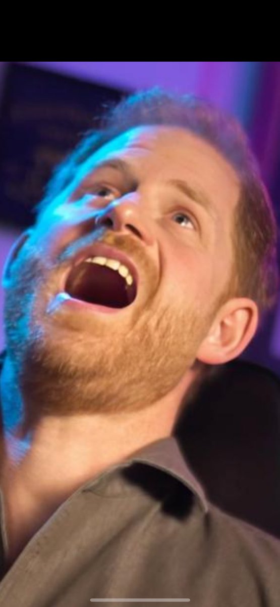 I think he has had his teeth done??