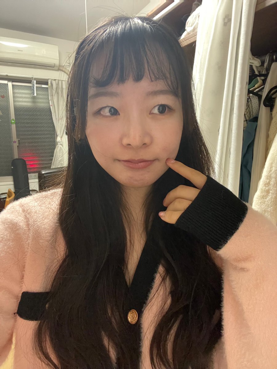 mia___tekito's tweet photo. 鼻整形　7〜9ヶ月

機能面の問題は全くなし！強いて言えば鼻水出るけど、元々出やすいから許容。
両顎後悩みだった正面からの鼻の穴が改善されたのが何より嬉しい☺️横から見た高さはかなり落ち着いたけど、高さ出しは優先度低めだったので問題なし✨
顔の加工✖️ https://t.co/Zky0gG2iTg