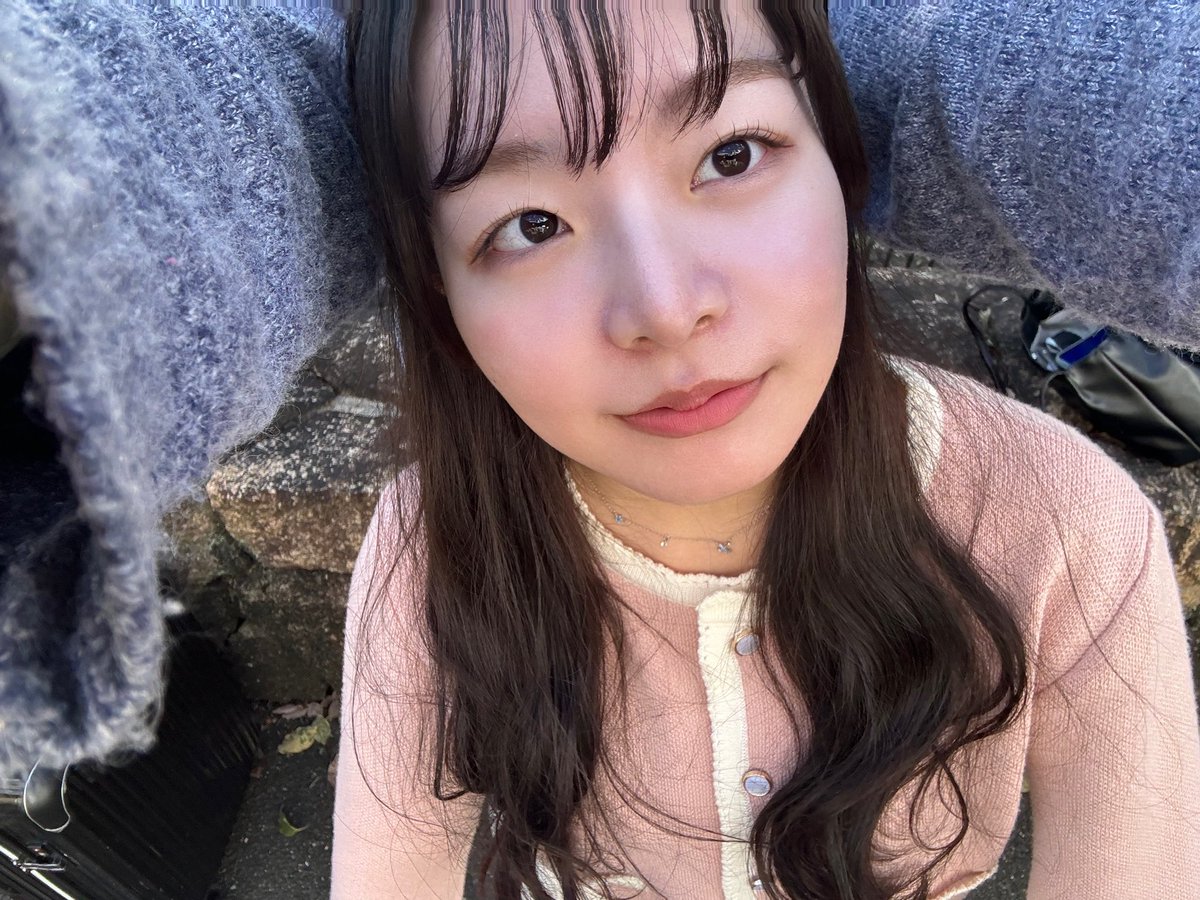 mia___tekito's tweet photo. 鼻整形　7〜9ヶ月

機能面の問題は全くなし！強いて言えば鼻水出るけど、元々出やすいから許容。
両顎後悩みだった正面からの鼻の穴が改善されたのが何より嬉しい☺️横から見た高さはかなり落ち着いたけど、高さ出しは優先度低めだったので問題なし✨
顔の加工✖️ https://t.co/Zky0gG2iTg