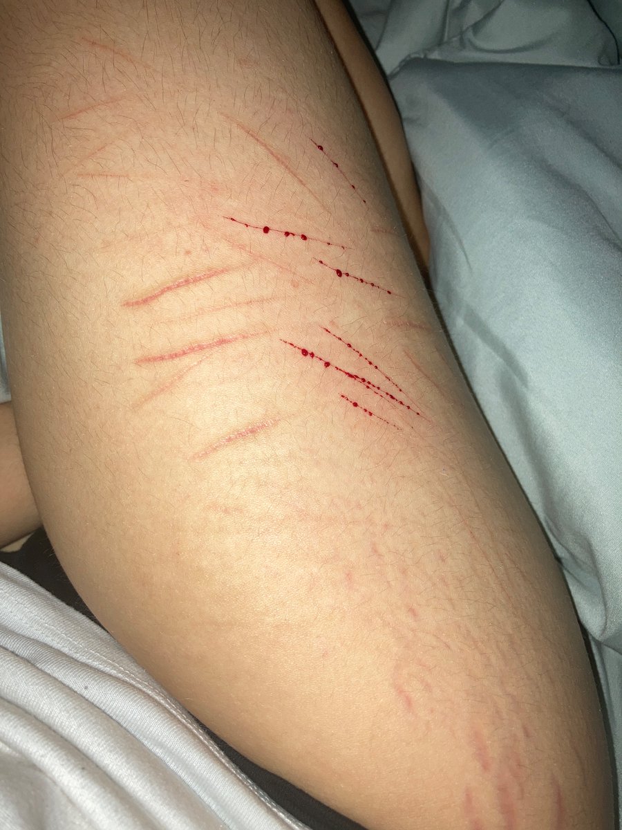 _AngelWynter_'s tweet photo. Old and new cuts https://t.co/O3A3evktF8