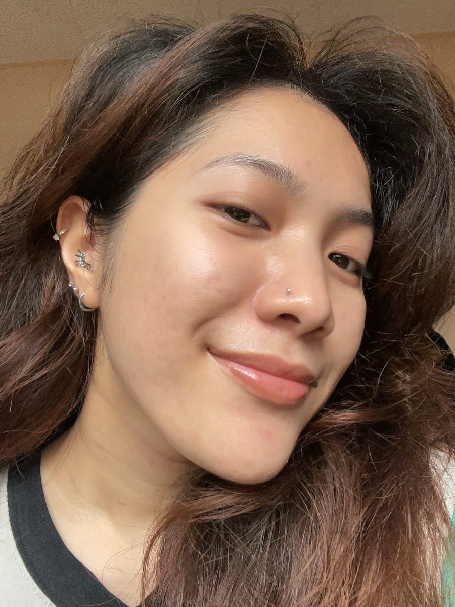 yanaazmill's tweet photo. Cleared my skin within less than a year. Yes I did that!

And no, I didn't go to any derms or aesthetician :) https://t.co/gn8TN2zGMU
