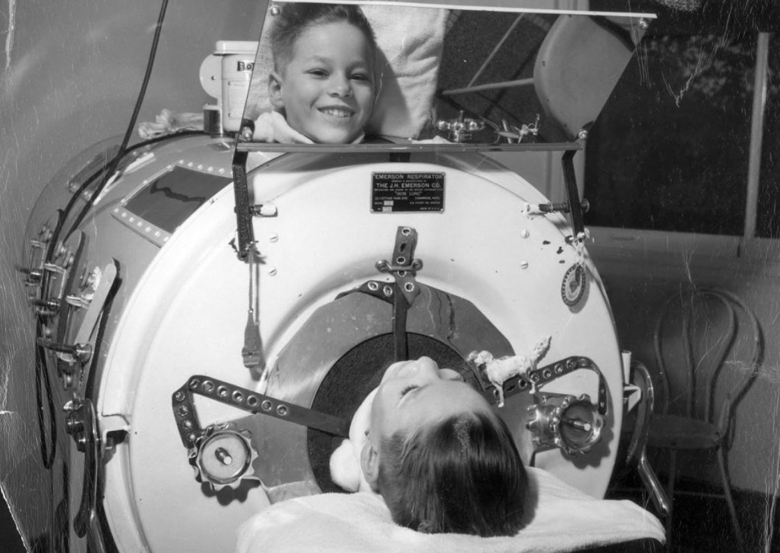 lonnibesancon's tweet photo. Dites les antivax, vous savez ce que c'est sur cette image? C'est un Iron Lung. Vous savez pourquoi vos gamins ont une chance de jamais finir là dedans ou d'en voir de leurs vies? C'est grâce à la vaccination.
1/3 https://t.co/m8VH5vOicJ