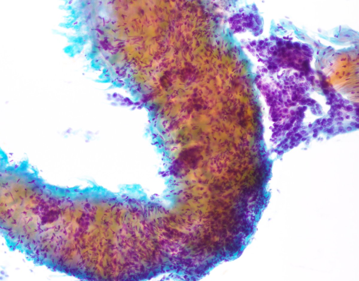 Vanda Torous MD tweet media