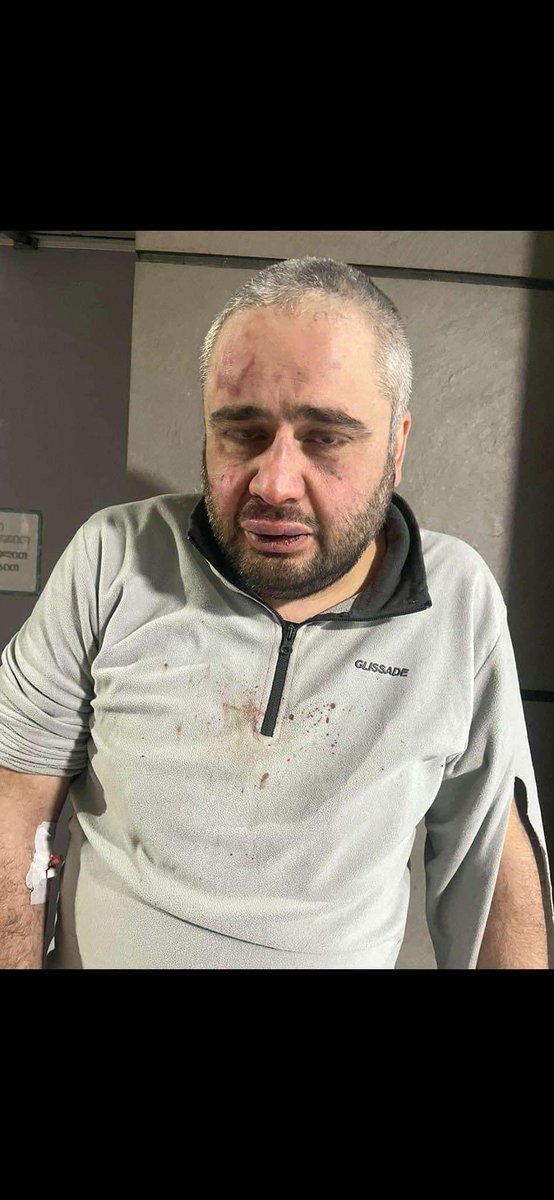 Traumatologist Vato Gvazava was beaten during a protest. According to his friend, the they assaulted him even more after they found out that he is a doctor.

#GeorgiaProtests