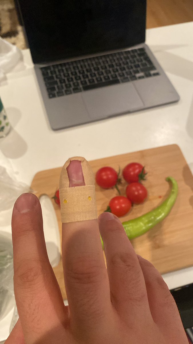cartcurtbey's tweet photo. şeriatın kestiği parmak https://t.co/mk9DBa0RRV