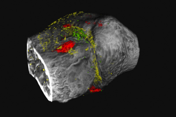 New technique allows technicolor imaging of degenerative joint disease: Photon-counting CT scanner uses novel contrast agents in rats to observe multiple biological processes, revealing evidence of osteoarthritis long before clinical symptoms develop

➡️ bit.ly/3Z54BVk