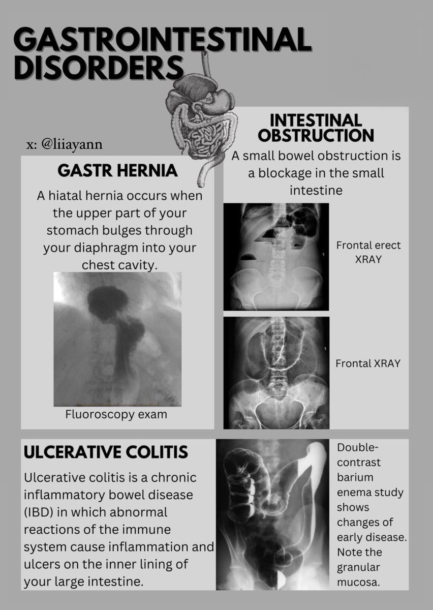 some GIT disorders in radiology ...