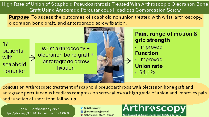 ArthroscopyJ's tweet photo. High Rate of Union of Scaphoid Pseudoarthrosis Treated With Arthroscopic Olecranon Bone Graft Using Antegrade Percutaneous Headless Compression Screw #scaphoid #nonunion #wrist #arthroscopy https://t.co/Tf5wcIAo57 https://t.co/E557r2AP0A